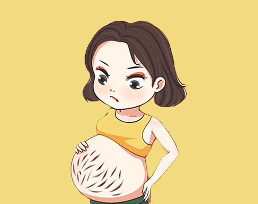 凹槽型妊娠纹