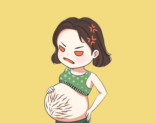 挛缩型妊娠纹