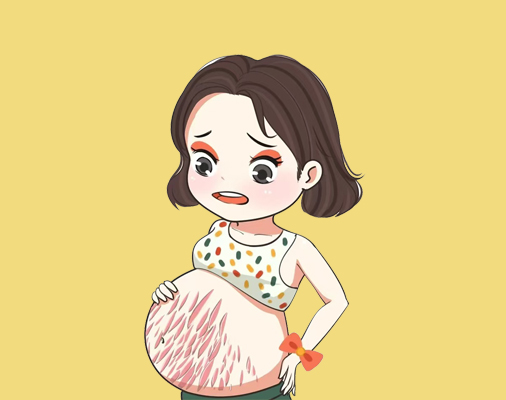 撕裂型妊娠纹